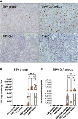 Primary Peripheral Epstein-Barr Virus Infection Can Lead to CNS Infection and Neuroinflammation in a Rabbit Model: Implications for Multiple Sclerosis Pathogenesis